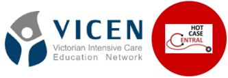VICEN Hot Cases Club